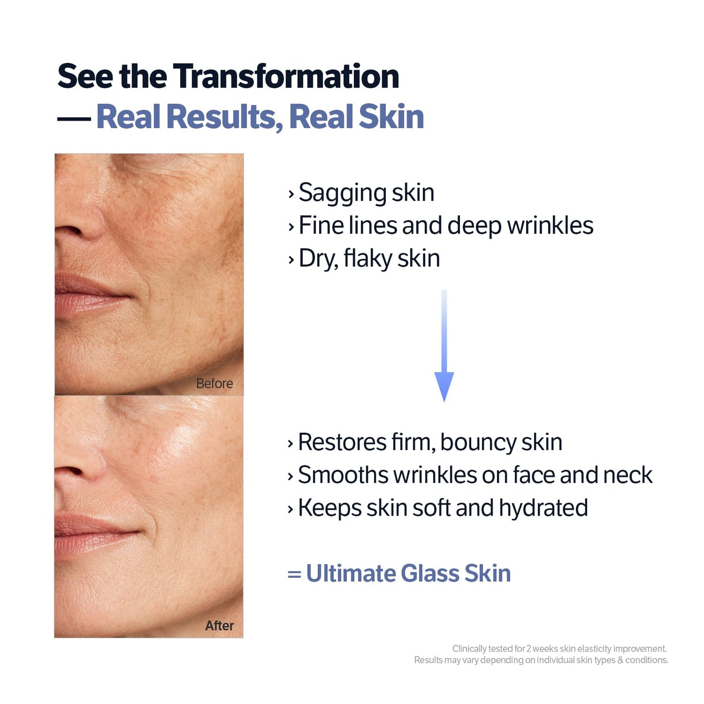 SUNGBOON EDITOR Deep Collagen Retinol Power Boosting Capsule Cream, Microneedling, White Spicules, Skin Firming, Hydration for Dry Skin, Wrinkles