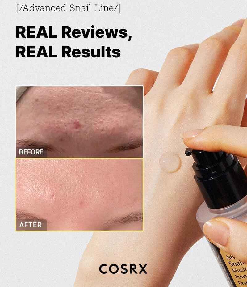 COSRX Snail Mucin 96% Power Repairing Essence, Hydrating Serum for Face with Snail Secretion Filtrate for Dull Skin & Fine Lines - Koraya Beauty