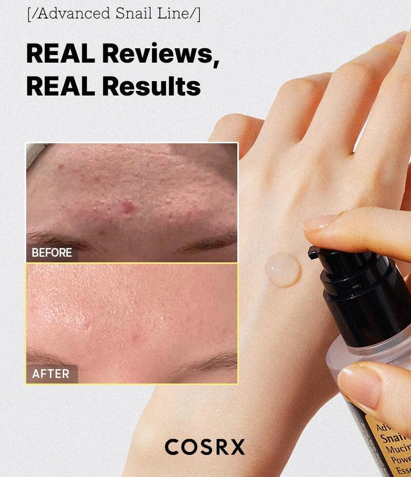 COSRX Snail Mucin 96% Power Repairing Essence, Hydrating Serum for Face with Snail Secretion Filtrate for Dull Skin & Fine Lines