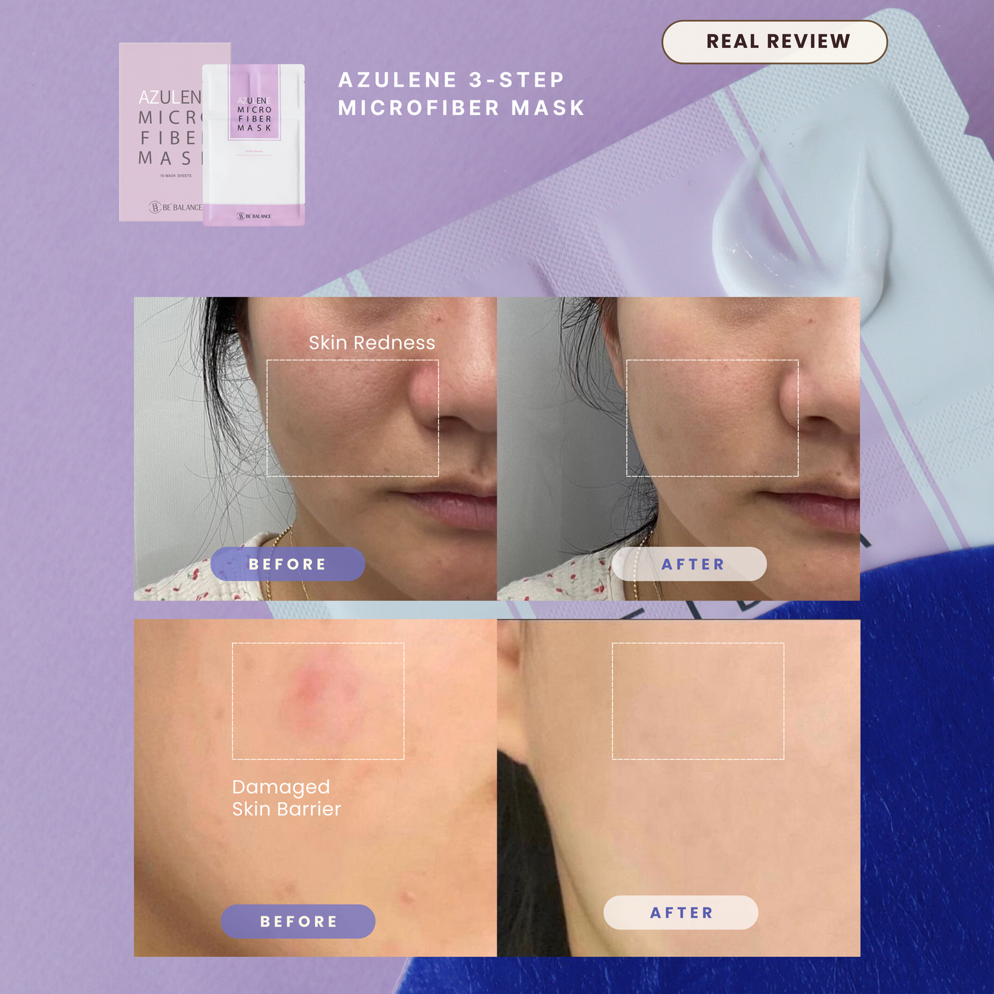 AZULENE Microfiber Mask