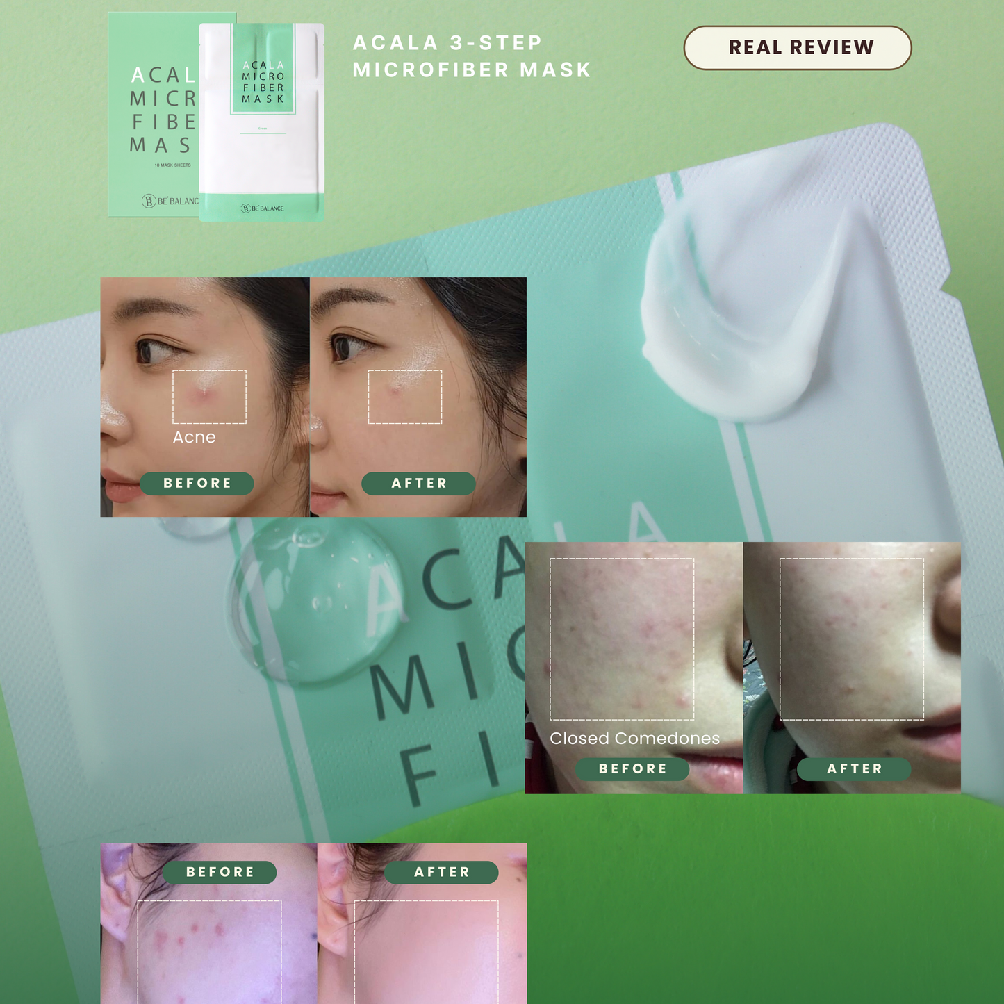Advertisement for Bé Balance Acala 3-Step Microfiber Mask with before and after effects on skin.