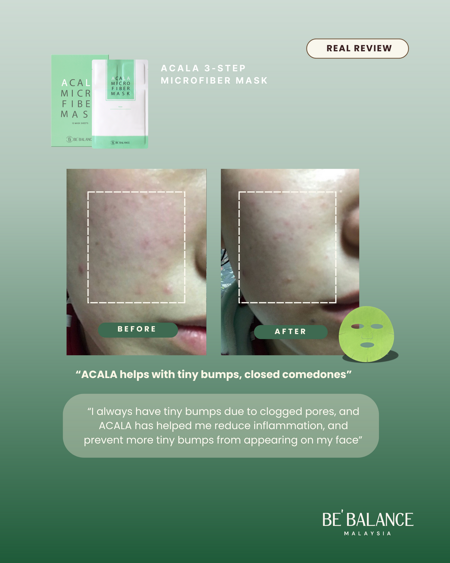 ACALA Microfiber Sheet Mask