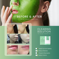 Before and after skin transformation with a green face mask and product packaging.
