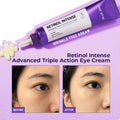 SOME BY MI Retinol Intense Advanced Triple Action Eye Cream