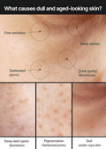 CELIMAX Pore+Dark Spot Brightening Cream, with Niacinamide, Tranexamic Acid, TXA Cream, Pore Minimizer - Koraya Beauty