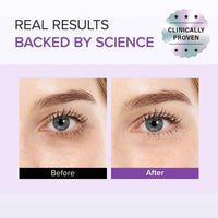 Mary&May TXA + Glutathione Eye Cream – image 8
