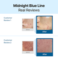 Dear, Klairs Midnight Blue Calming Cream – image 2