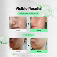VT Cosmetics Cica Reedle Shot 300 Serum – image 5