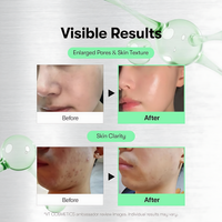 VT Cosmetics Cica Reedle Shot 100 Serum – image 2