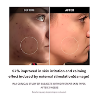 Aprilskin Carrotene Clarifying Serum – image 6
