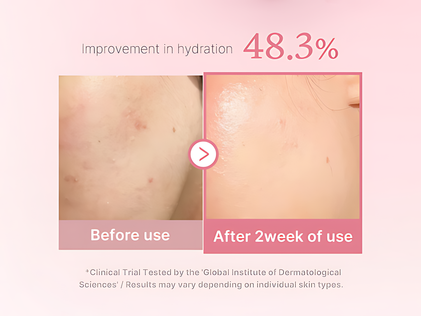MEDICUBE PDRN Pink Niacinamide Milky Toner for Hydrating, Moisturizing, Soothing, Ceramide, Peptide, Glass Glow Skin - Koraya Beauty