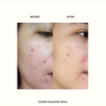 PURITO Centella Unscented Serum, 34,860 ppm Centella, Facial Serum for Sensitive Skin & Acne-Prone Skin, Soothing Serum - Koraya Beauty
