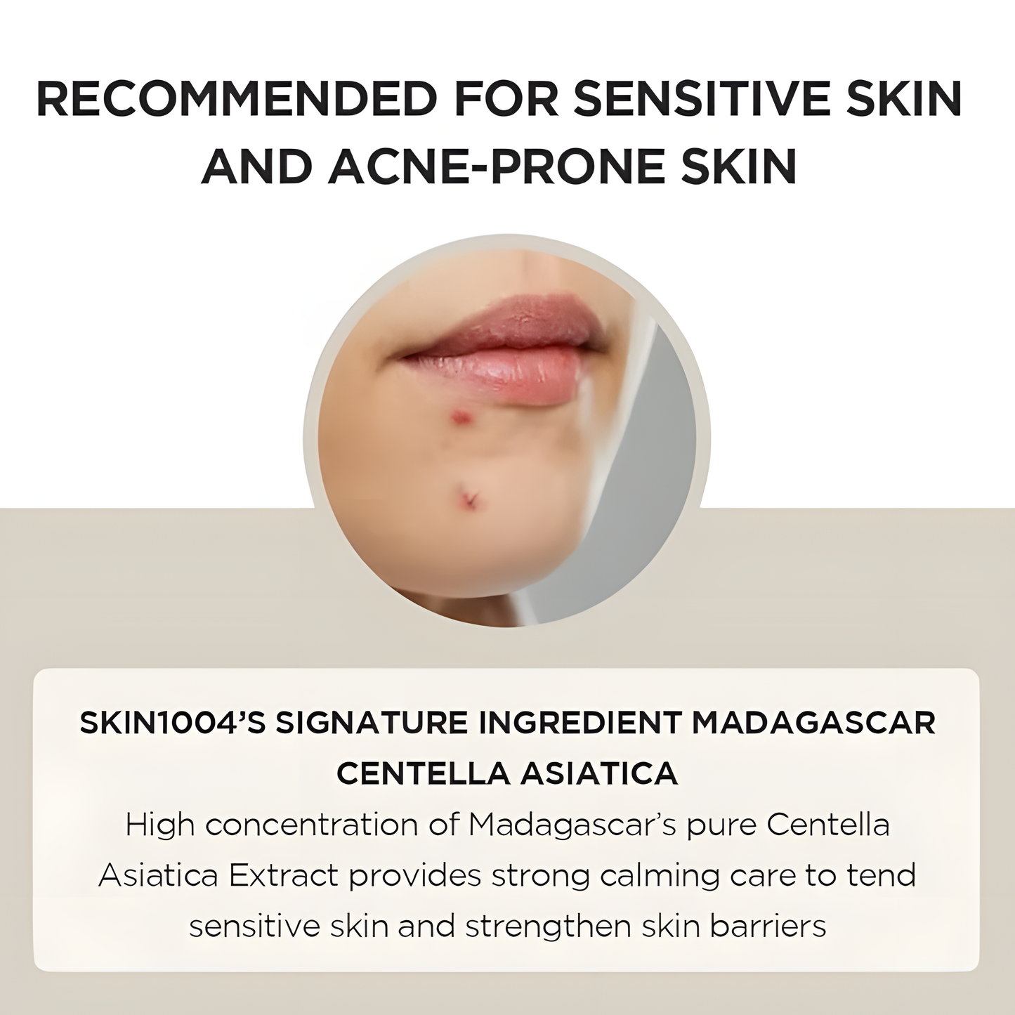 SKIN1004 Madagascar Centella Asiatica Ampoule Facial Serum