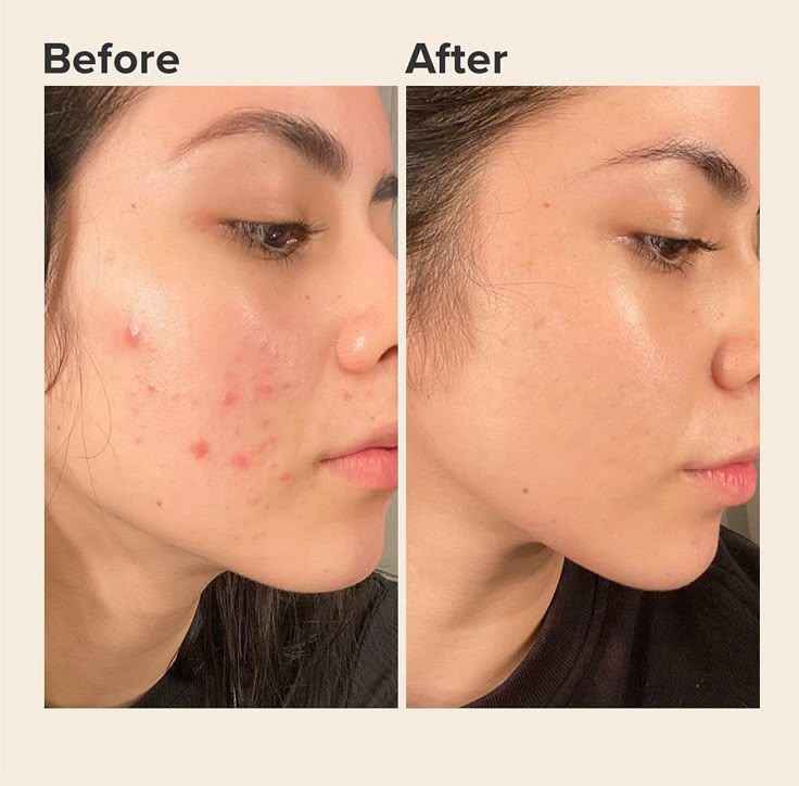 AXIS-Y Dark Spot Correcting Glow Serum with 5% & Rice Bran, Firming & Moisturizing Face Serum for Uneven Skin Tone, Vegan & Cruelty-Free Korean Skin Care - Koraya Beauty